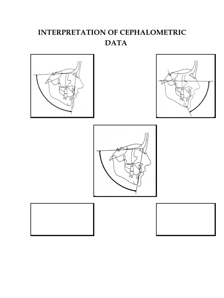 Cephalometric Analysis Techniques | PDF | Primate Anatomy | Human Anatomy