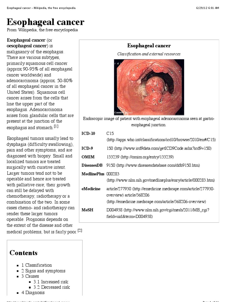 Esophageal Cancer Wikipedia, The Free Encyclopedia Esophageal