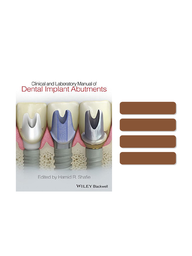 Clinical and Laboratory Manual of Dental Implant Abutments 1st Edition ...