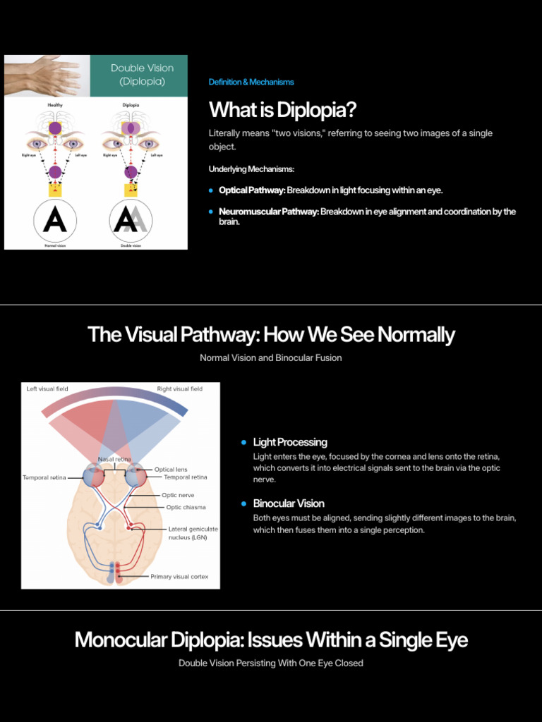 Beautiful.ai - Understanding Diplopia Causes and Mechanisms of Double ...
