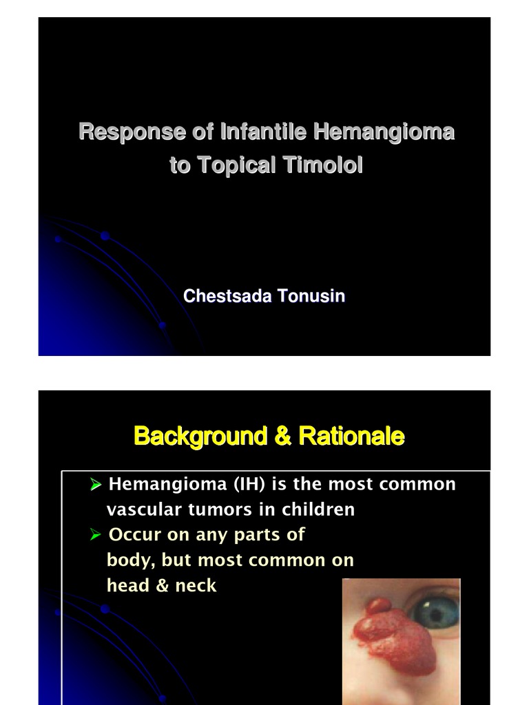 Topical Timolol Solution in Hemangioma in Thailand Health Sciences