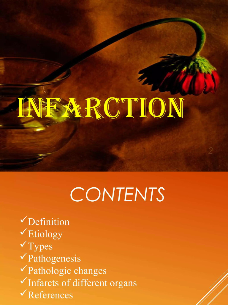 Infraction | PDF