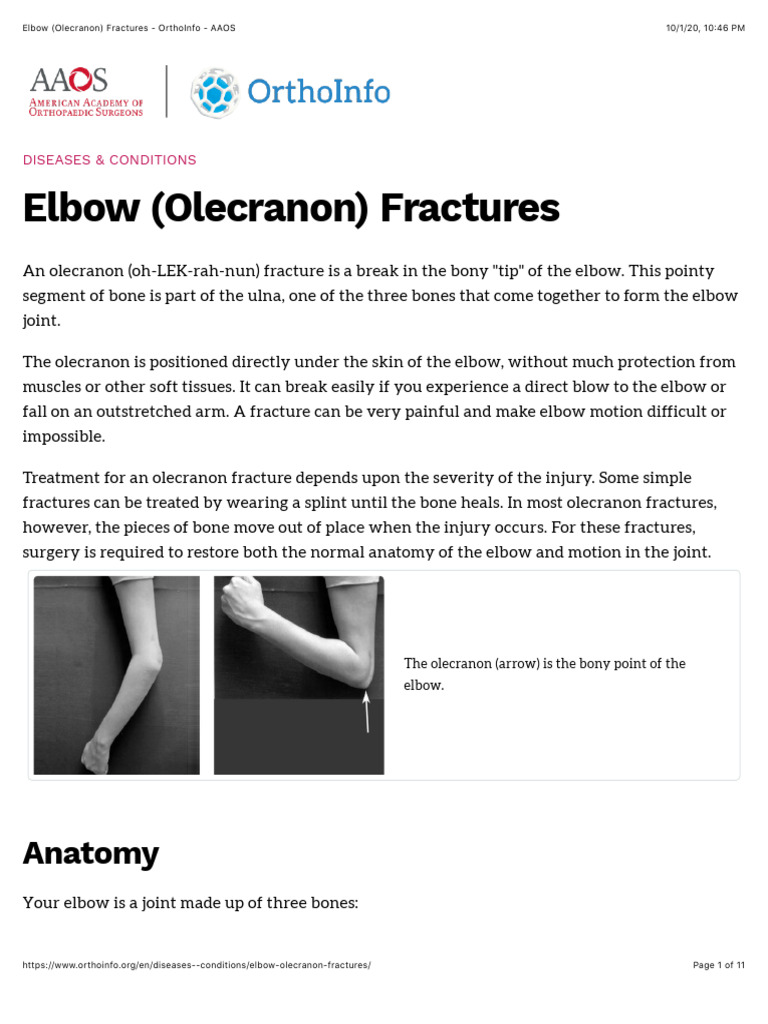Elbow-Olecranon-Fractures-OrthoInfo-AAOS | PDF | Elbow | Arm