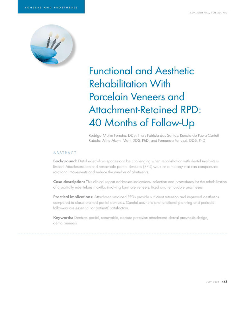 Funcional and Aesthetic Rehabilitation With Attachment Retained RPD | PDF