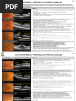 Understanding White Without Pressure (WWOP) | PDF | Vision | Ophthalmology