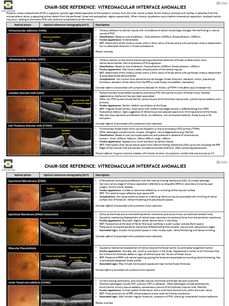 VMD | PDF | Retina | Ophthalmology