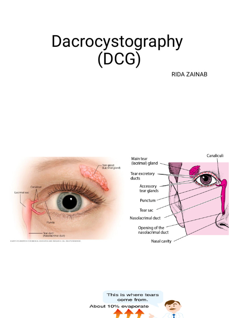 DCG, Sialography and Herniogram (1) | PDF