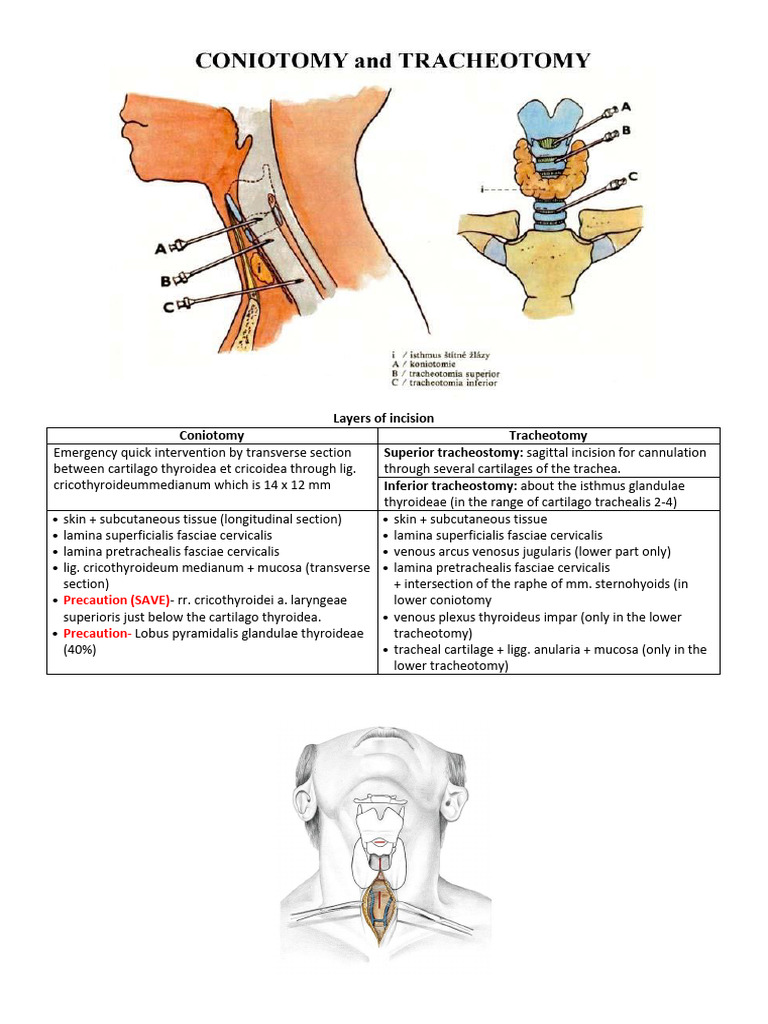 coniotomy | PDF