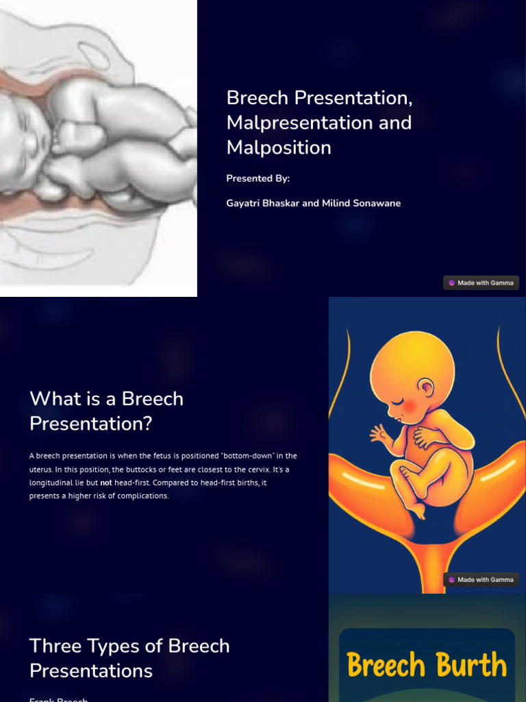 Breech Presentation Malpresentation and Malposition | PDF | Childbirth ...