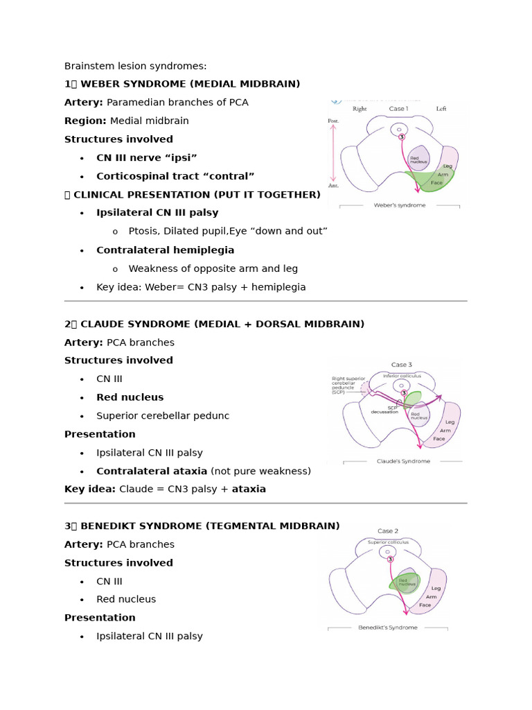 Brainstem Lesion Syndromes | PDF | Nervous System | Neurology