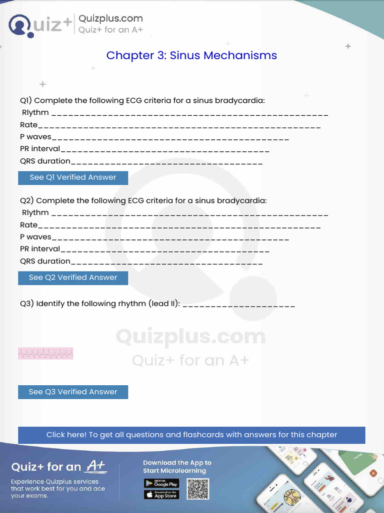 Complete the Following Ecg Criteria for a Sinus Bradycardia Rlythm ...