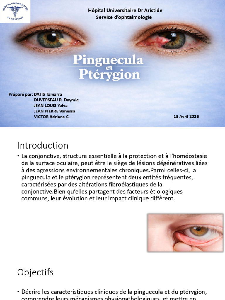 Copie de Présentation Ophtalmo 2.0 PDF Ophtalmologie Cornée — free download