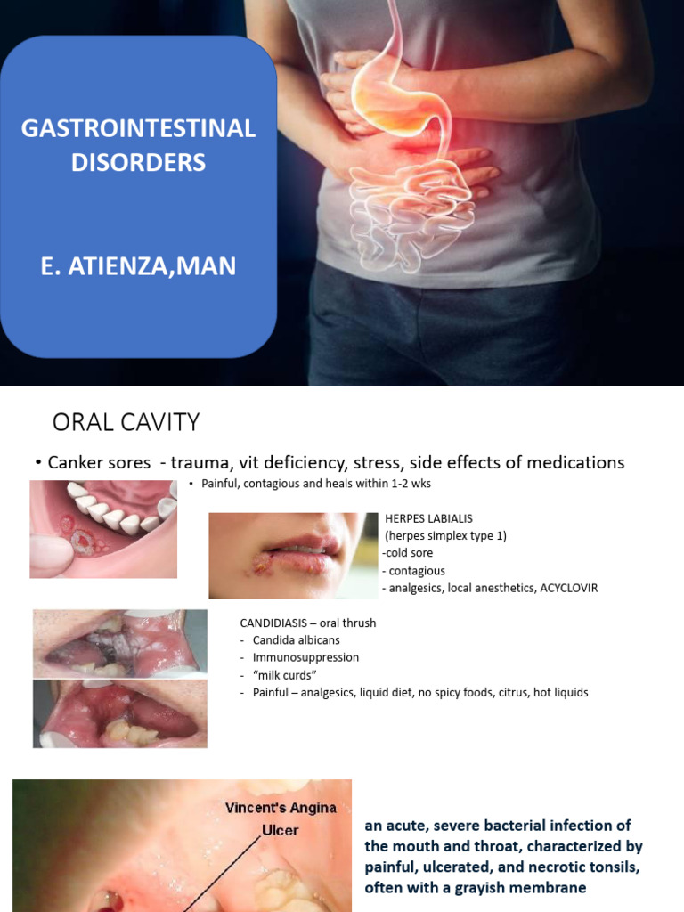 GI-DISORDERS | PDF | Gastroesophageal Reflux Disease | Esophagus