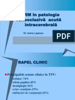 Tromboze Venoase Curs