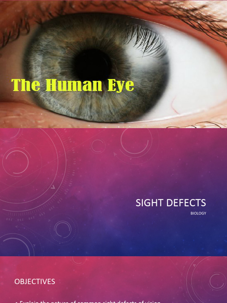 Eye Defects | PDF | Myopia | Glaucoma