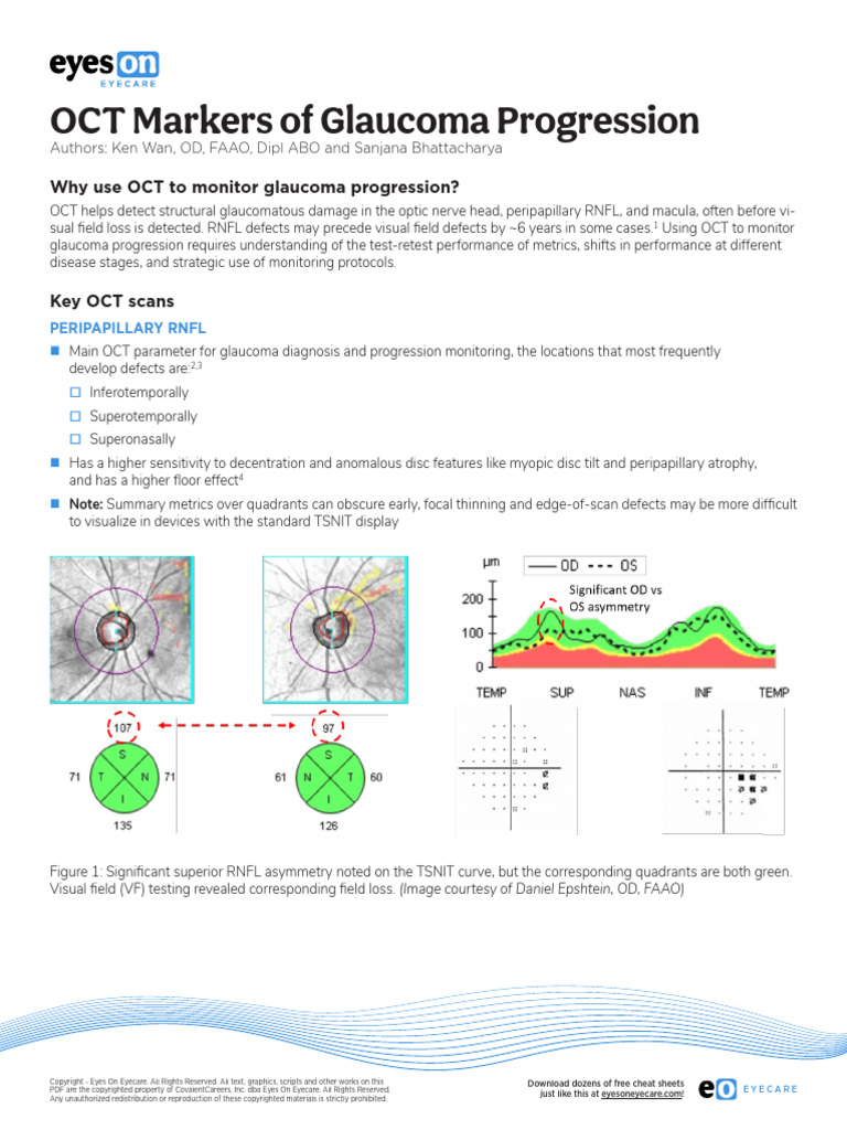 OCT Markers of Glaucoma Progression_Cheat-Sheet | PDF | Glaucoma | Retina