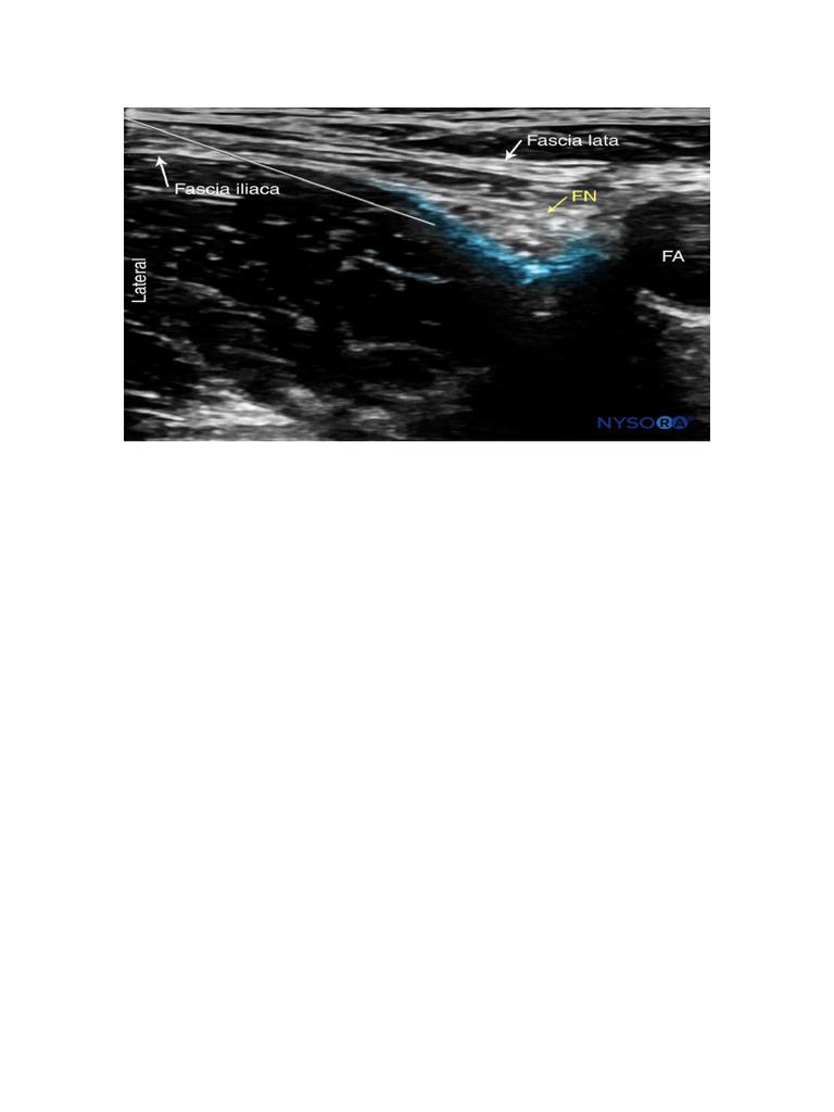 Lower_Extremity_Nerve_Blocks_Guidelines | PDF | Human Leg | Knee