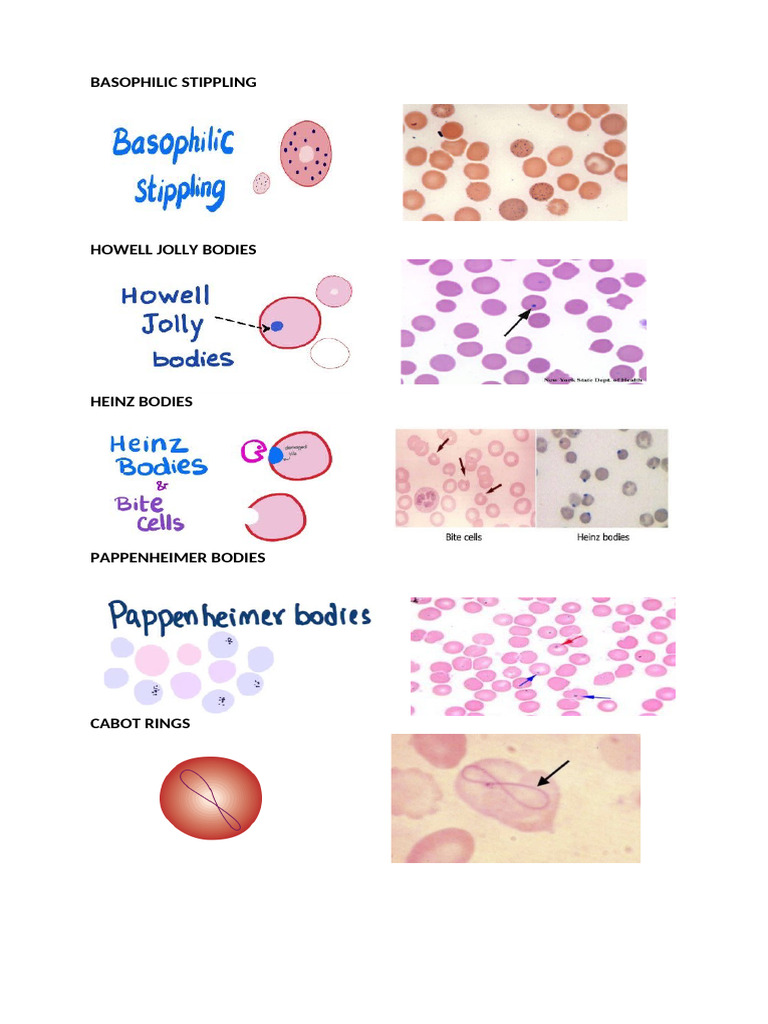 Basophilic Stippling | PDF