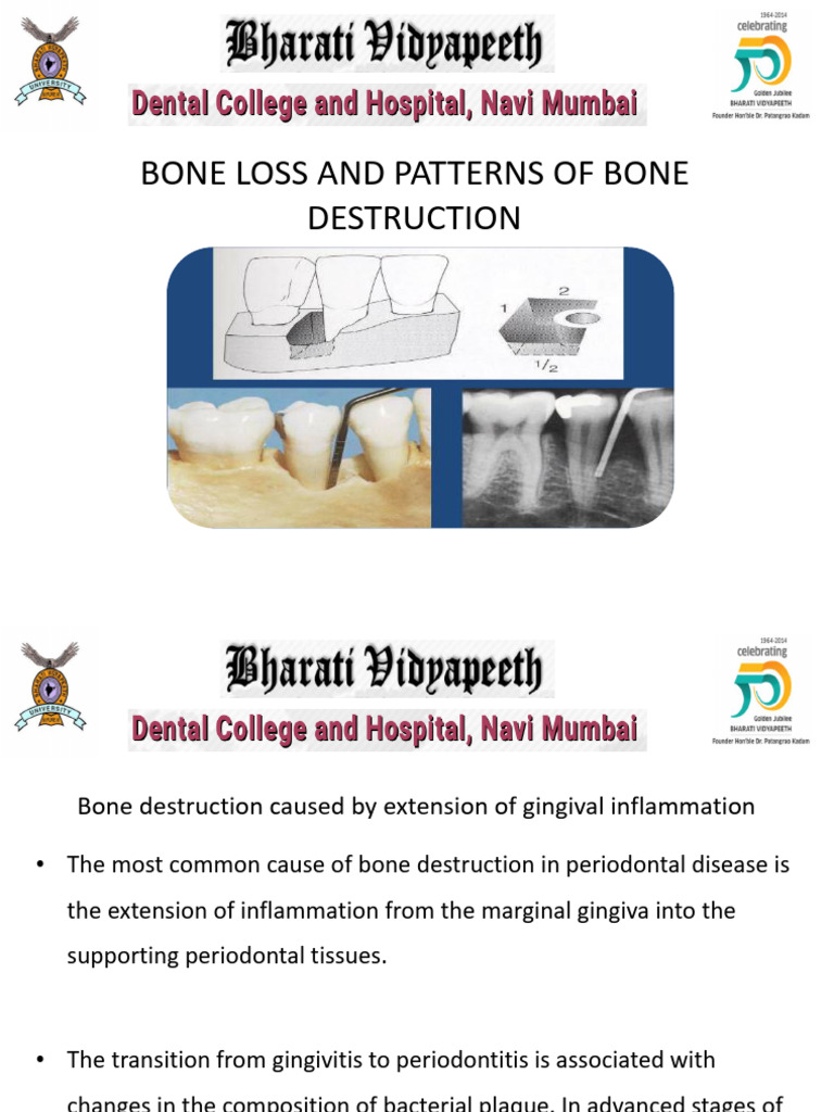 DR Sneh Agrawal, Bone Loss & Patterns of Bone Loss, PDF | PDF ...