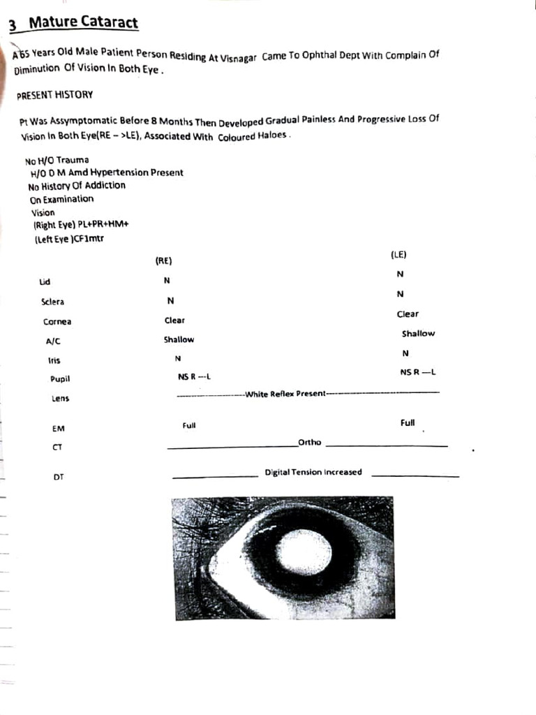 Ophthalm.case History | PDF