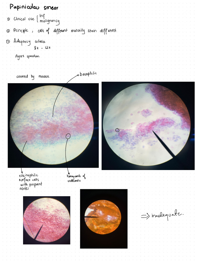 Pap smear | PDF