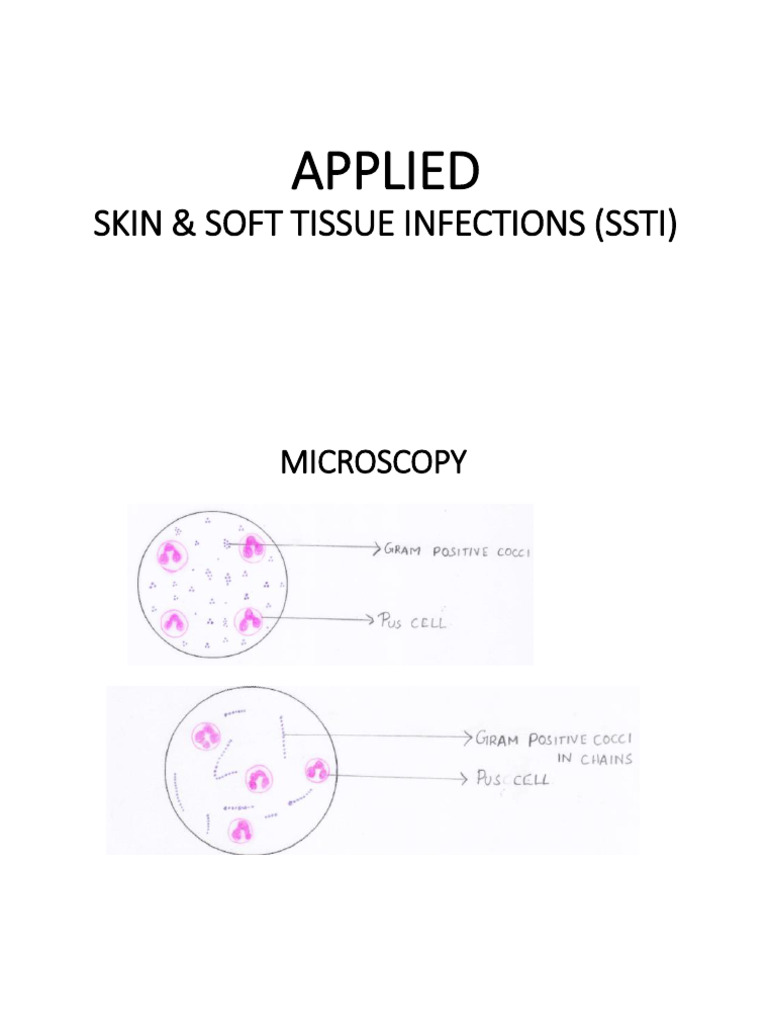 SSTI Applied Cases (Updated) | PDF | Streptococcus | Anthrax