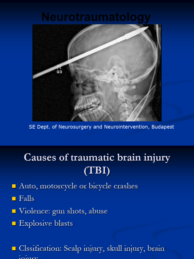 Neuro Traumatology | PDF | Traumatic Brain Injury | Nervous System