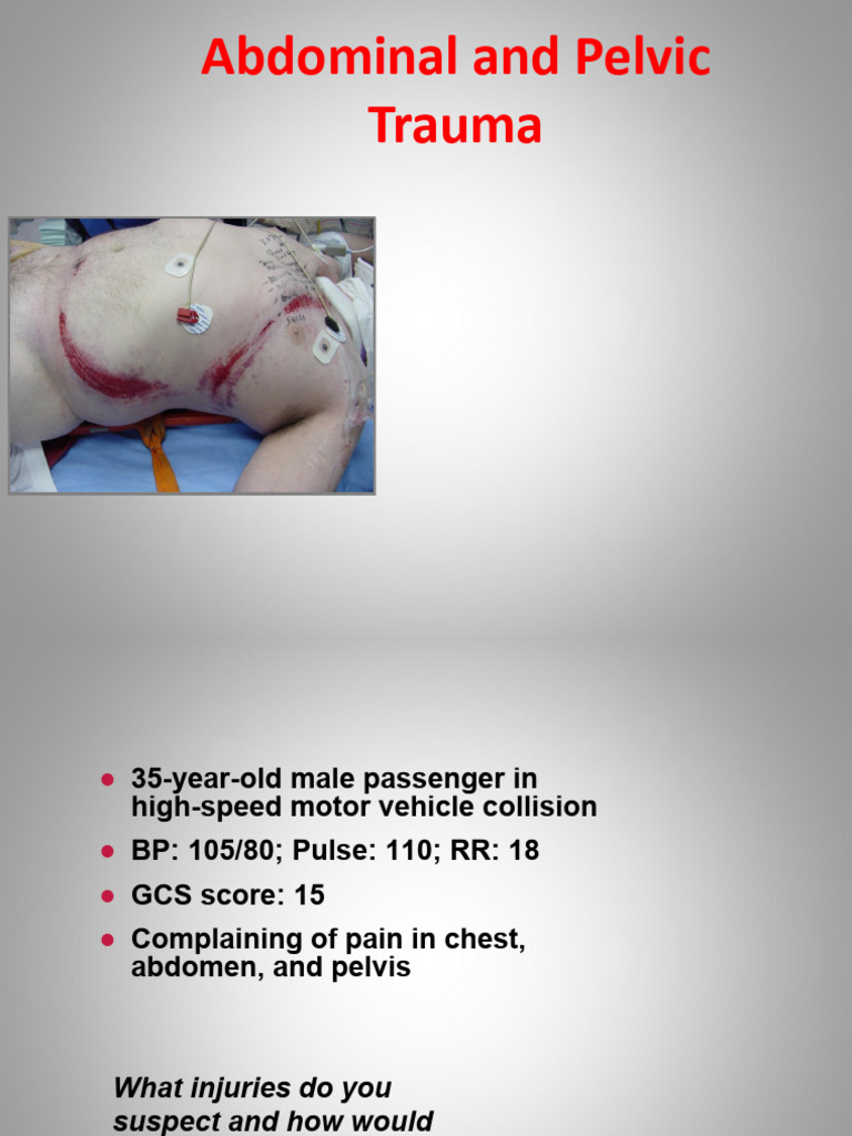 L2- abdominal trauma | PDF | Abdomen | Major Trauma