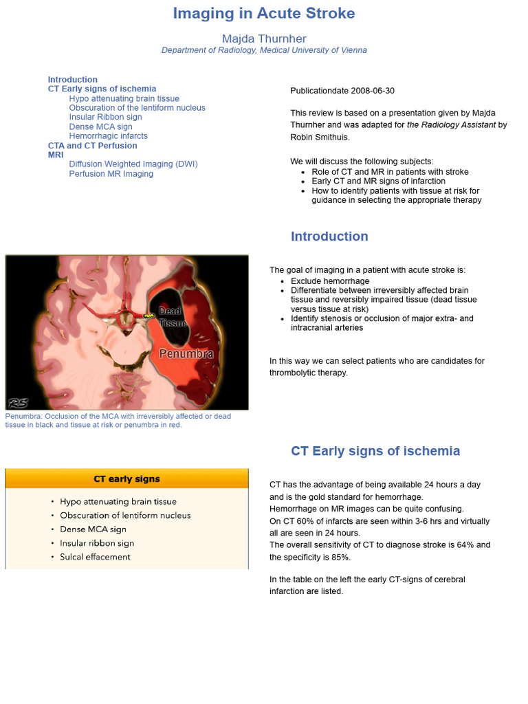 Imaging in Acute Stroke | PDF | Stroke | Ct Scan
