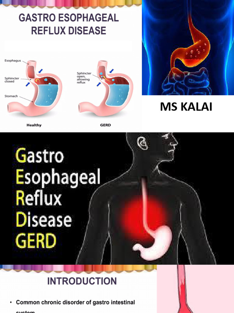 GERD_FINAL[1] | PDF