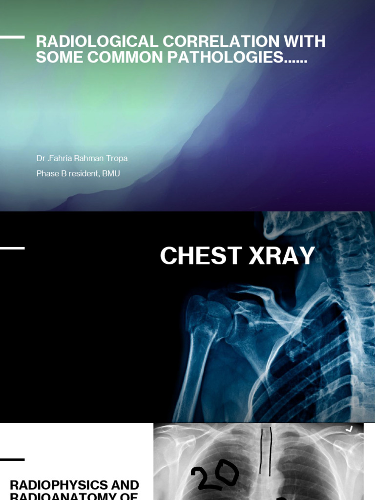 XRay Presentation | PDF