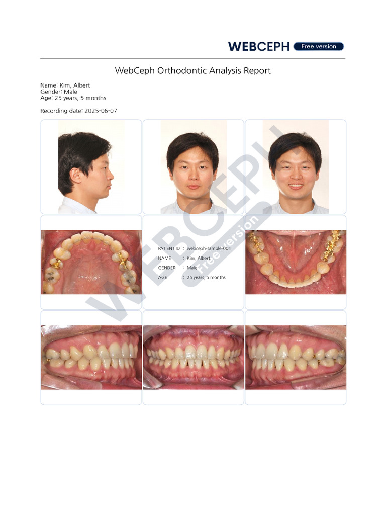 Webceph-sample-001 Total Diagnostic Records | PDF | Face | Tooth