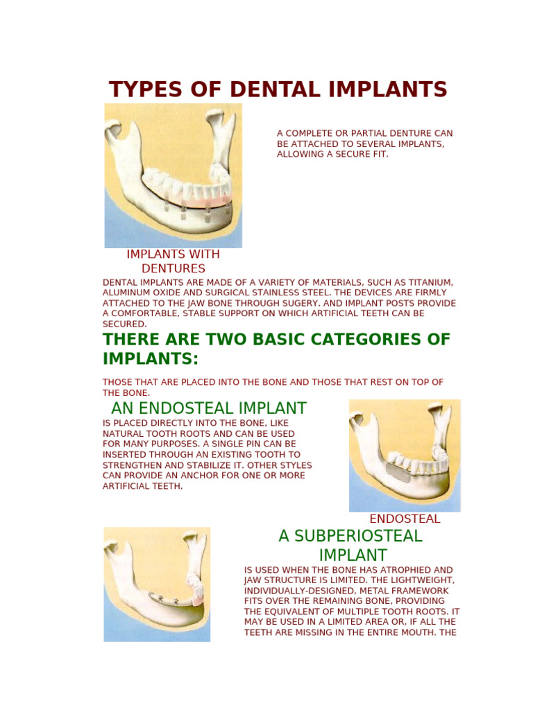 Types of Dental Implants (2) | PDF | Dental Implant | Dentures