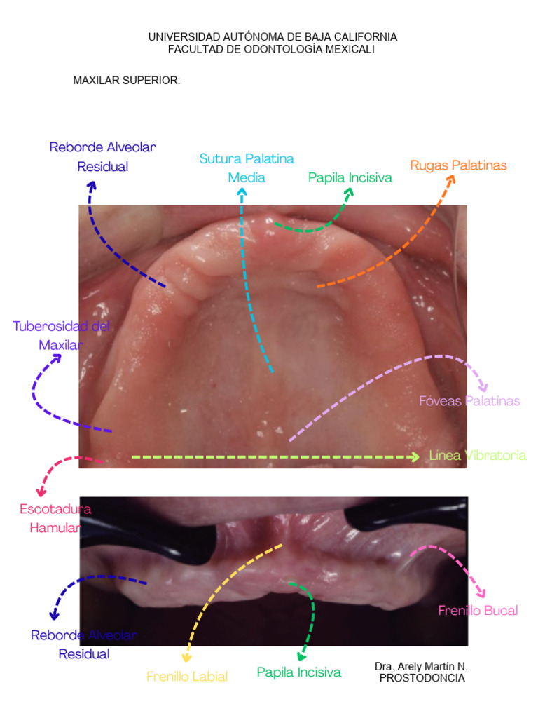 ANATOMIA MAXILARES. .pdf_20260312_180712_0000 | PDF