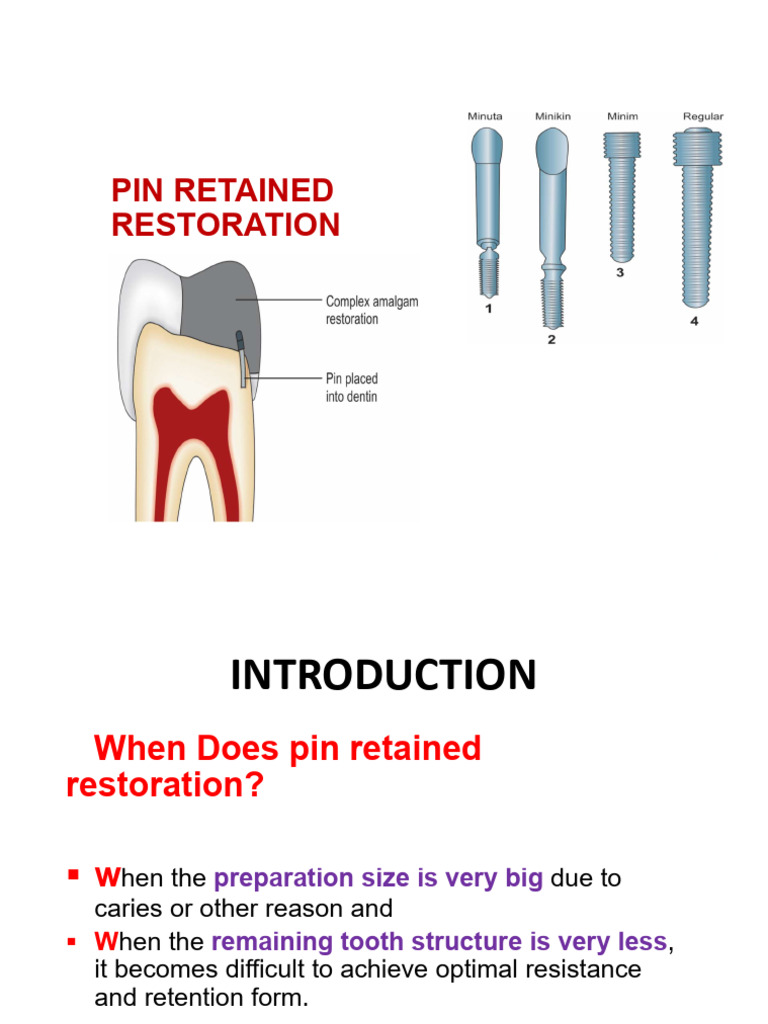 2. Pin Retained Restorations | PDF | Dentin | Fracture
