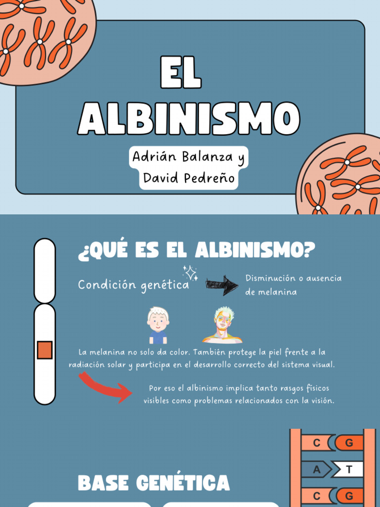 Albinism o | PDF