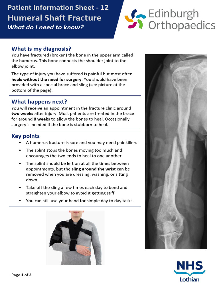 Humeral Shaft Fracture-12 | PDF | Clinical Medicine | Skeletal System