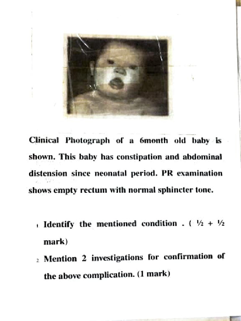 OSCE - Paeds Charts 2 | PDF