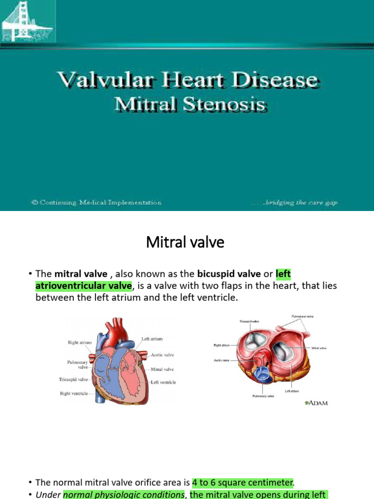 7 -Mitral Stenosis | PDF | Heart Valve | Atrium (Heart)