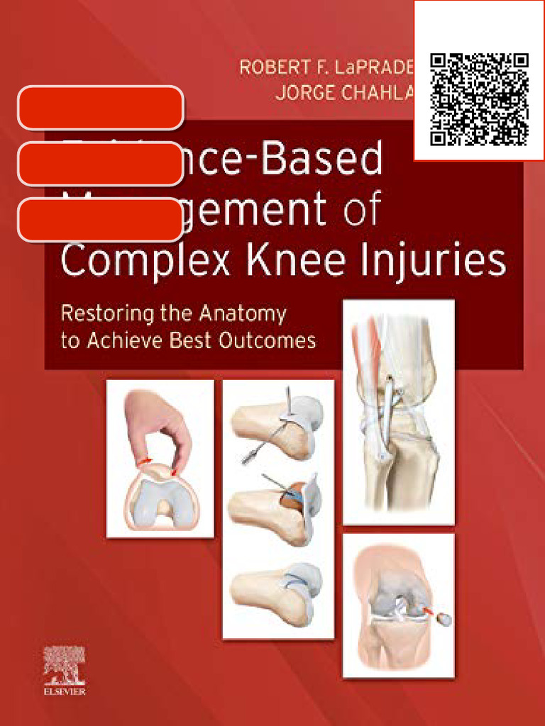 Ebook Evidence-Based Management of Complex Knee Injuries: Restoring the ...