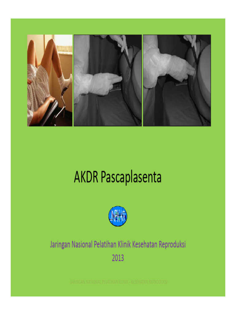 06 Prosedur Klinik Insersi AKDRPP | PDF