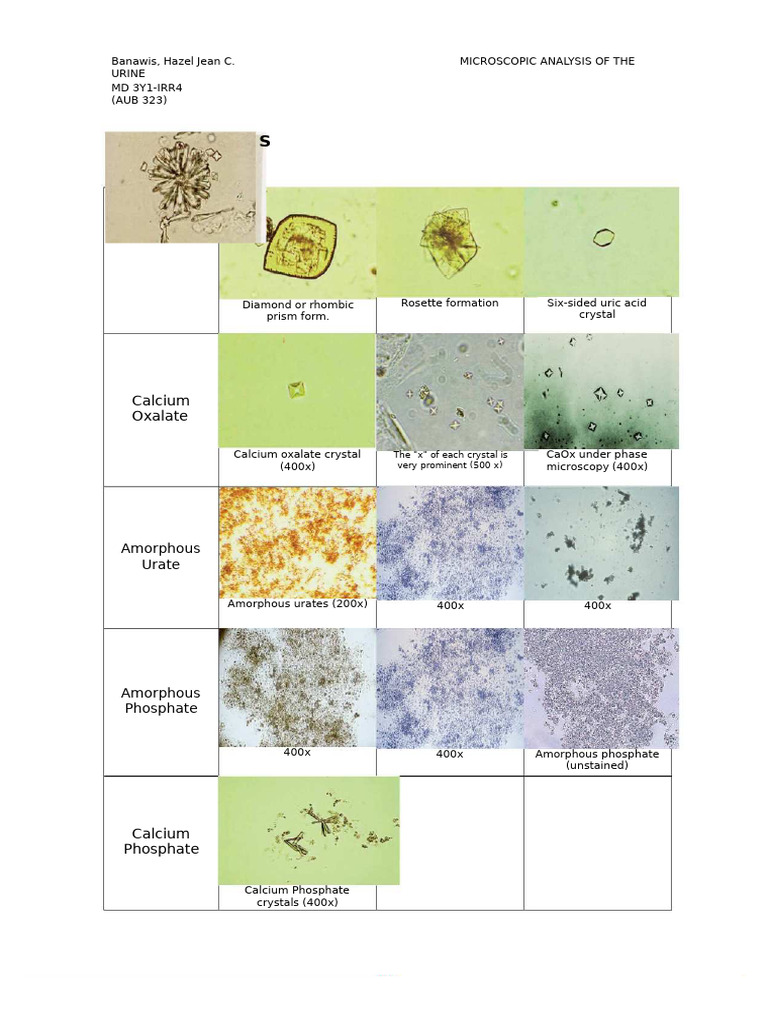 (Memorize This) Urine-sediments | PDF