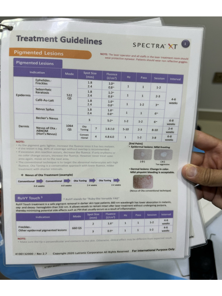 Spectra Parameters | PDF