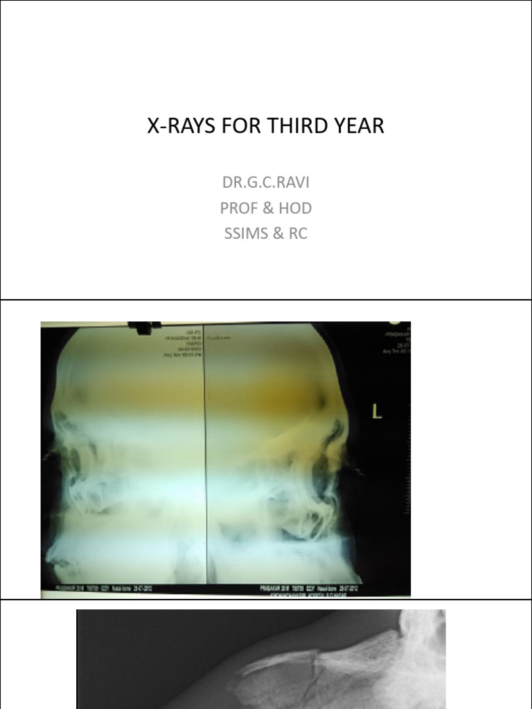 Revision Class 3rd Year X-rays | PDF | Esophagus | Medical Specialties
