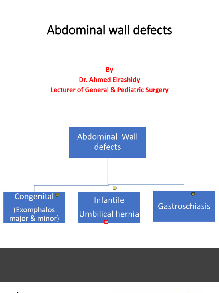 Abdominal Wall Defects | PDF | Abdomen | Medical Specialties