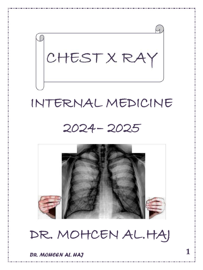Chest X Ray Med Easy | PDF | Respiratory Diseases | Lung