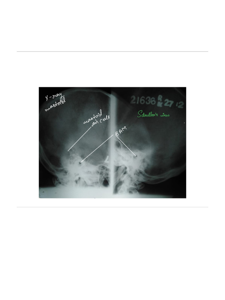 ENT Xray Explanations | PDF