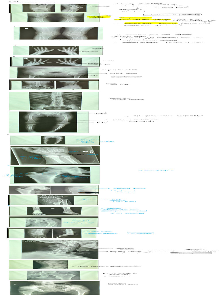 X ray | PDF