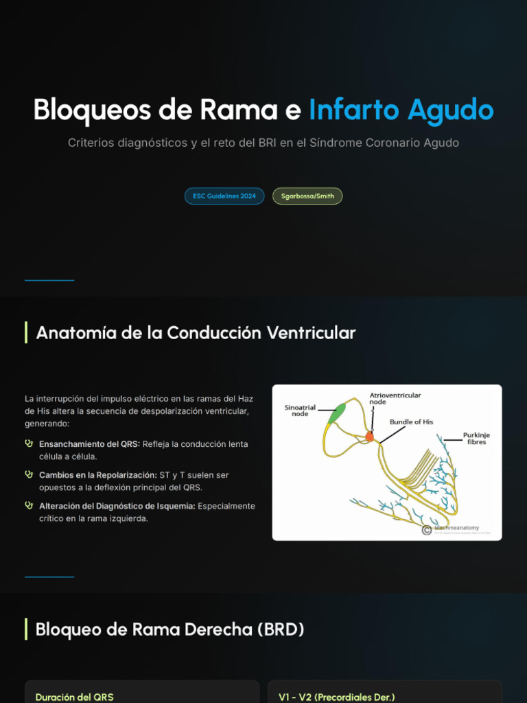 Bloqueos de Rama e Infarto Agudo | PDF