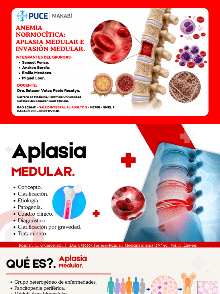 APLASIA MEDULAR E INVASIÓN MEDULAR_20260505_193252_0000 | PDF ...